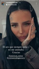 Cande Tinelli se perforó la cara: 