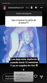 Barby Franco confesó cuál es el miedo que le genera ser madre por primera vez