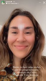 La técnica casera de Jimena Barón que es furor para eliminar arrugas del rostro