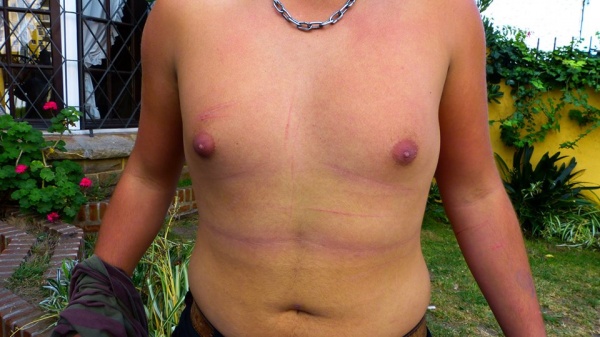 Denuncian a la policía de Miramar por “secuestrar” y “torturar” a joven